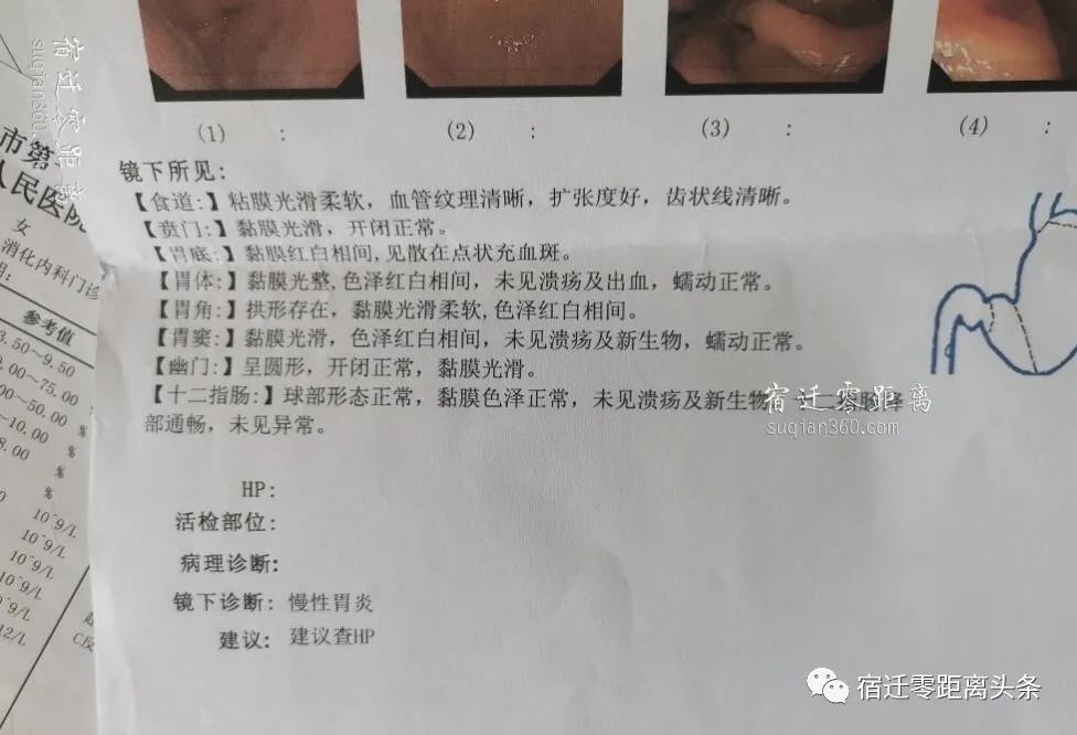 网友投诉：这就是南京鼓楼医院的医生医德，是以赚钱为目的还是什么？