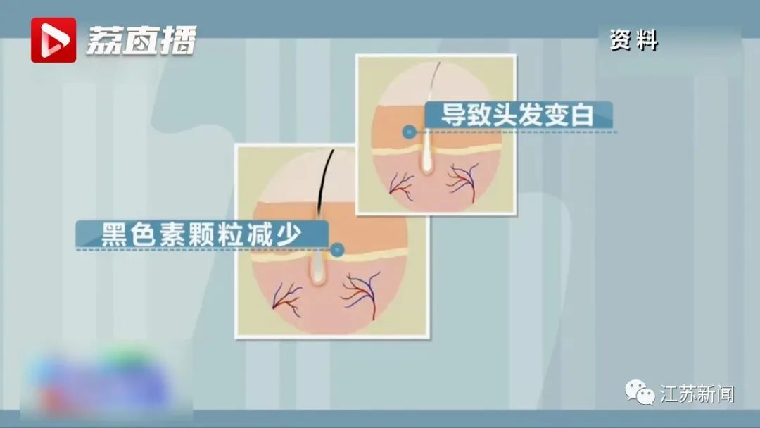 白头发“拔1根长10根”？有必要拔吗？医生说……